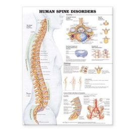 Human Spine Disorder Chart